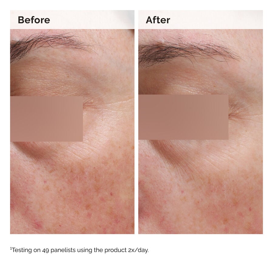 Niacinamide 5% Face and Body Emulsion - US 6335