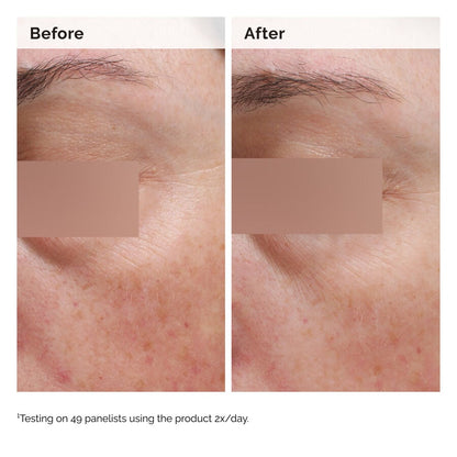 Niacinamide 5% Face and Body Emulsion - US 6335