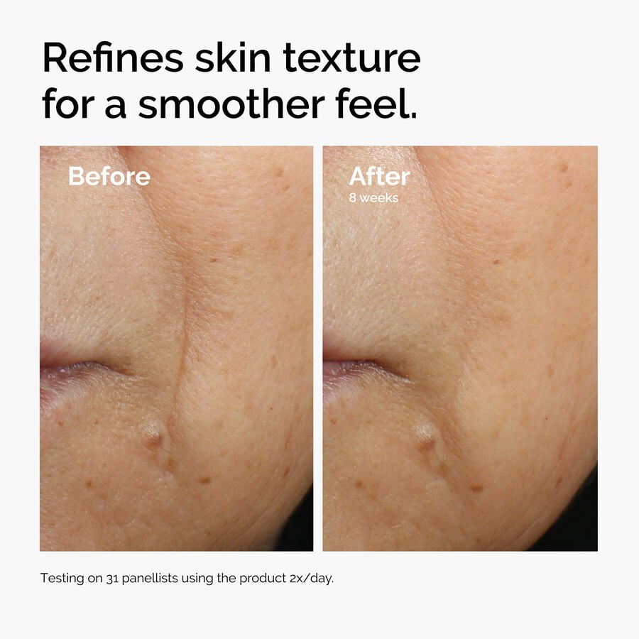 Caffeine 3% + Escin 1% Face Serum - US 6928