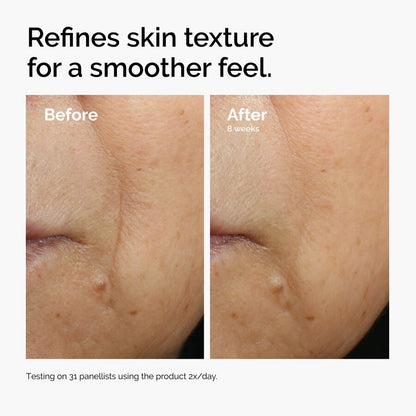Caffeine 3% + Escin 1% Face Serum - US 6928