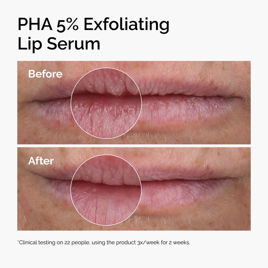 PHA 5% Exfoliating Lip Serum - US 9381