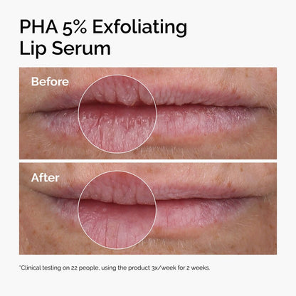 PHA 5% Exfoliating Lip Serum - US 9381