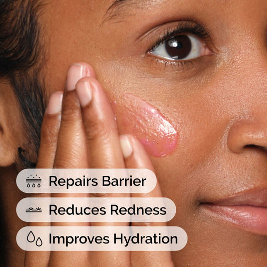 Soothing &amp; Barrier Support Serum - US 4000